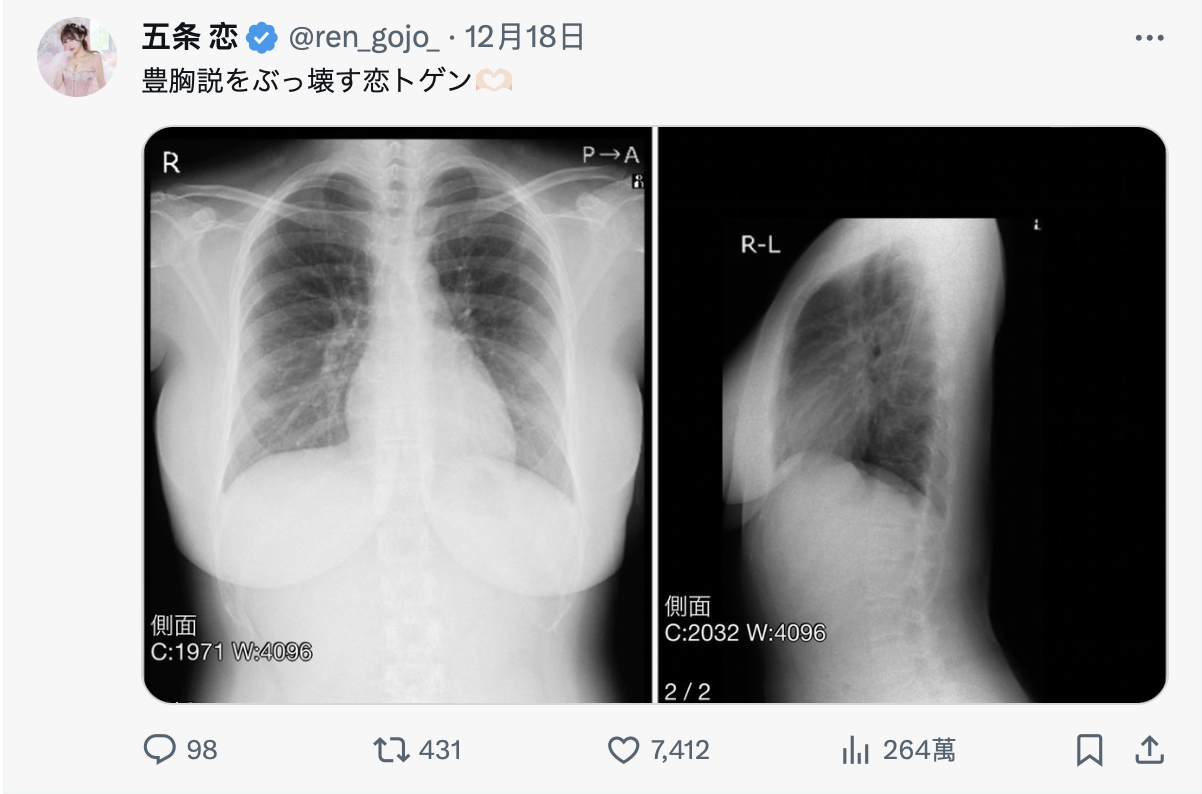 TSE最胸战士！五条恋不是一片限定！-图片6